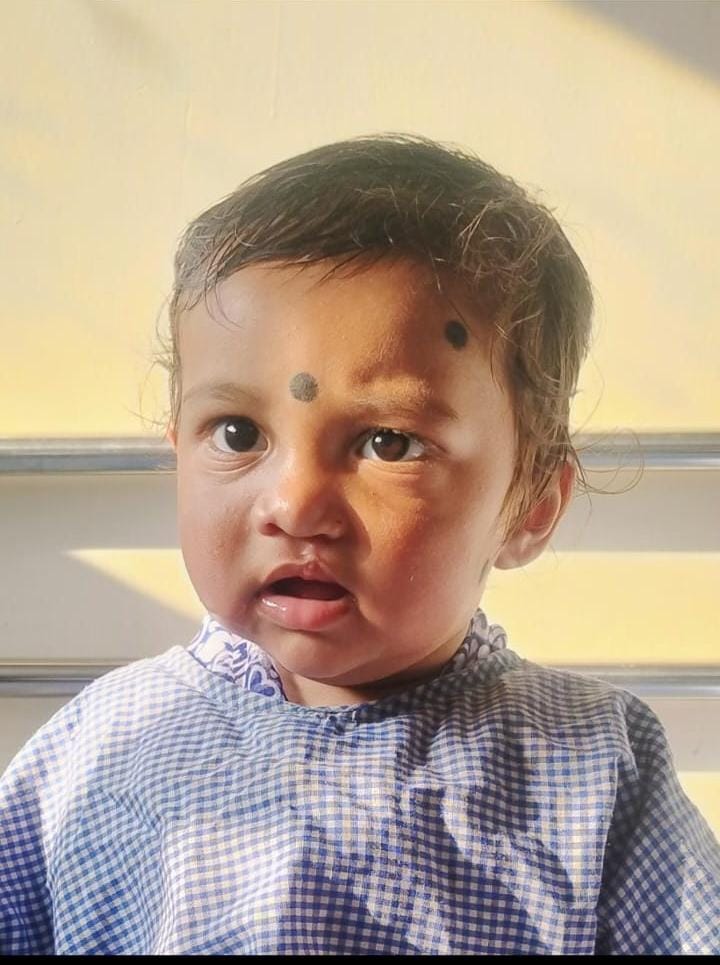 गर्वित को जन्मजात विकृति से मिली निजात,चिरायु से&nbsp;रायपुर के निजी अस्पताल में होंठ एवं तालू का कराया गया निःशुल्क ऑपरेशन,परिजनों ने सीएम का जताया आभार