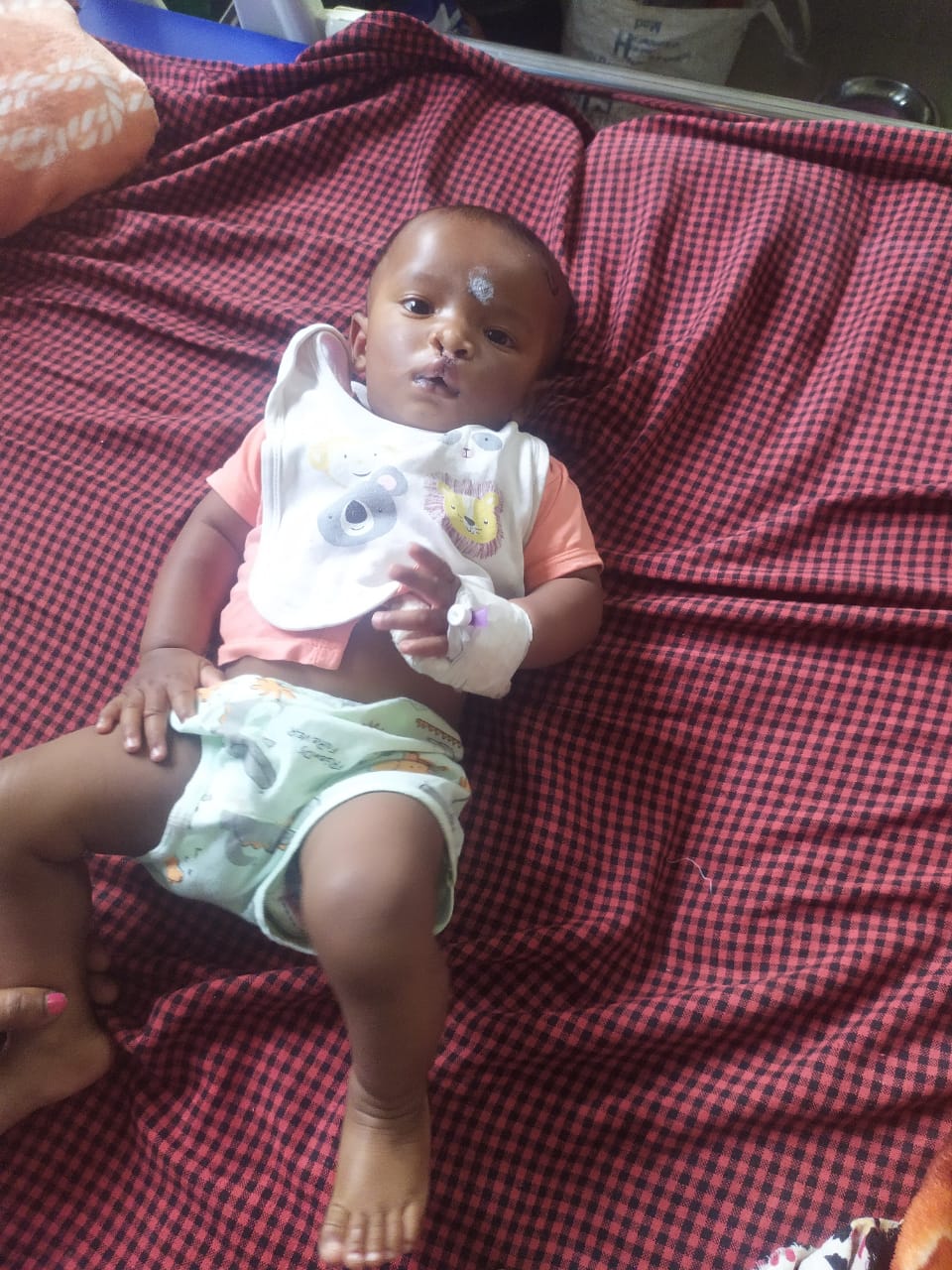 नोवेल के जन्मजान होंठ व तालू का चिरायु योजना के थी एक निजी अस्पताल में निःशुल्क ऑपरेशन सहित मिली अन्य मेडिकल सुविधा....परिजनों ने सीए का जताया आभार