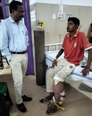 सीएम कैंप कार्यालय बना जिलेवासियों के लिए संजीवनी बूटी,हाथीपांव से पीड़ित का इलाज जिला चिकित्सालय में शुरू